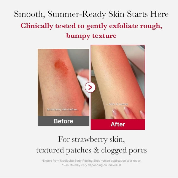 Red Body Peeling Shot – Strawberry Skin Exfoliating Spray – 110 g  | MOQ: 50 Pcs | B0D9561GC4