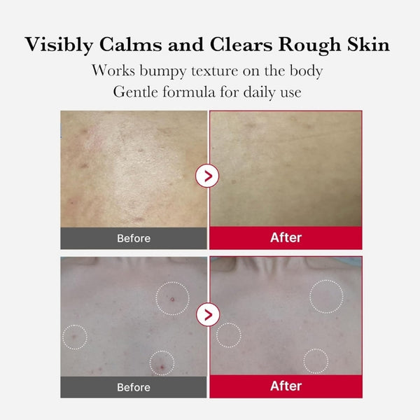 Red Body Peeling Shot – Strawberry Skin Exfoliating Spray – 110 g  | MOQ: 50 Pcs | B0D9561GC4