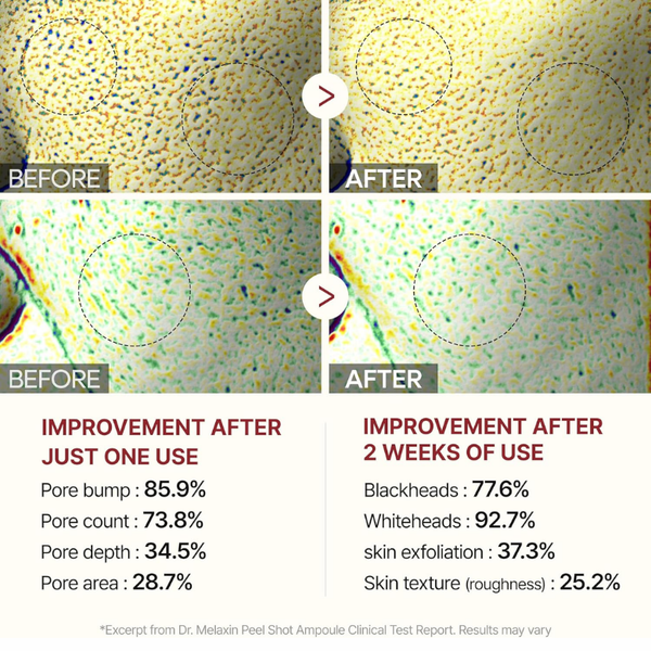 أمبولة بييل شوت غوماج - 80 مل