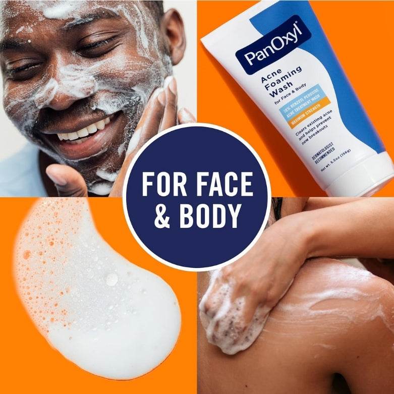 Acne Foaming Wash 10% BP Max Strength 5.5oz (MOQ 50)