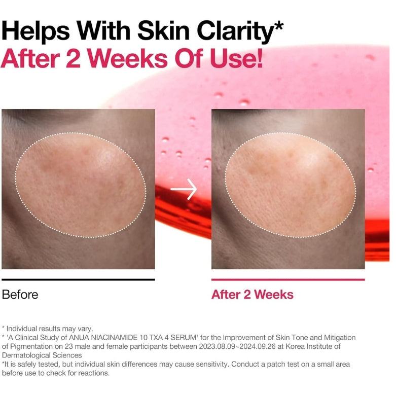10% Niacinamide Serum – 30 ml