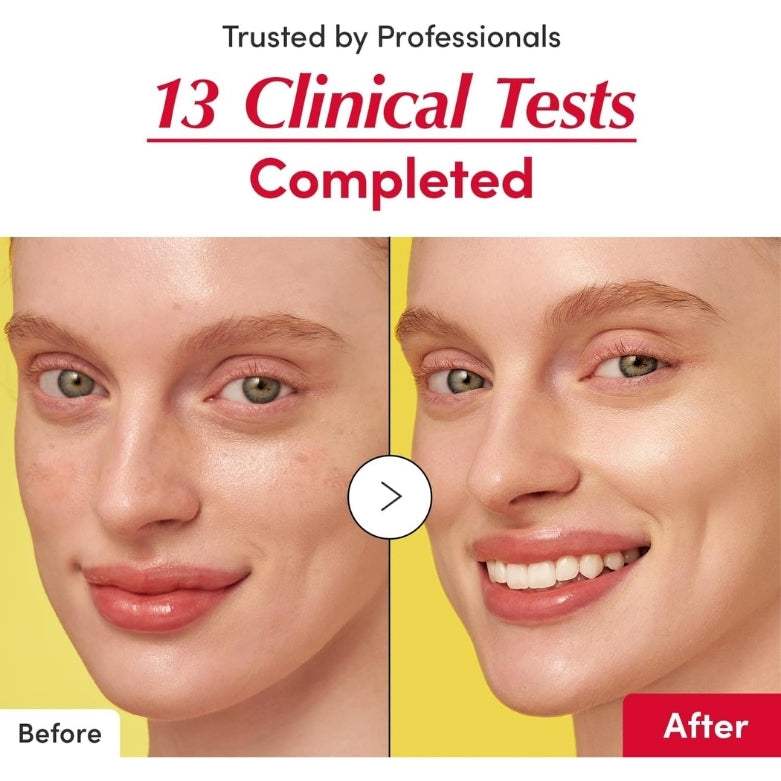 Brightening Serum with Vitamin C - 30ml for Radiant & Even Skin Tone