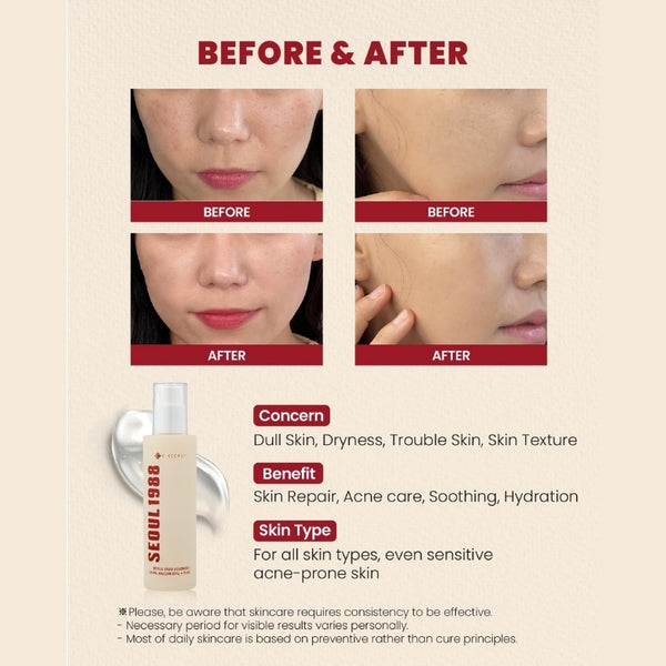 Snail Mucin 97% + Rice 100 ml | MOQ: 30 Pcs | B0DCQ71XRT