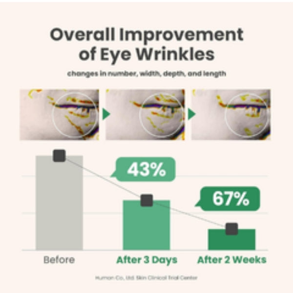 سيروم الكولاجين النباتي للعينين – 10 مل