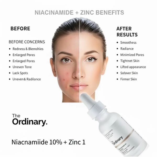 Niacinamide 10% + Zinc 1%, 30 ml | MOQ: 30 Pcs | B08BJLFM2W