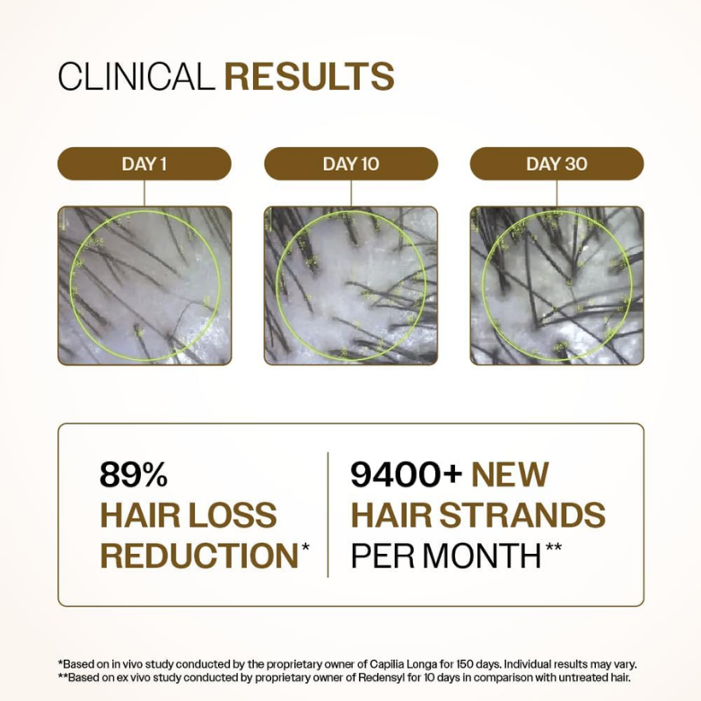 Advanced Hair Growth Serum  30mL | MOQ 50 Pcs | B0CT5FKBR7