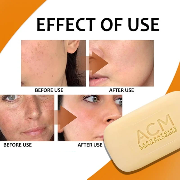 صابون سيبيونكس المنقي 100 غرام