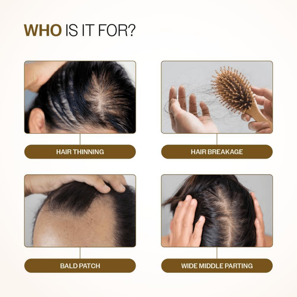 Advanced Hair Growth Serum  30mL | MOQ 50 Pcs | B0CT5FKBR7